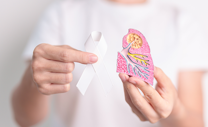 Akciğer Kanseri Farkındalık Ayı